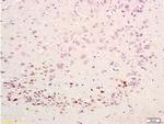 CDK5 Antibody in Immunohistochemistry (Paraffin) (IHC (P))