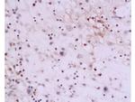 IL-13 Antibody in Immunohistochemistry (Paraffin) (IHC (P))