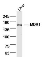 MDR1 Antibody in Western Blot (WB)