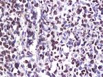 CDK6 Antibody in Immunohistochemistry (Paraffin) (IHC (P))