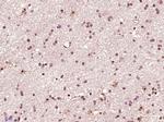 CDK6 Antibody in Immunohistochemistry (Paraffin) (IHC (P))