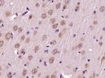 Dynamin 2 Antibody in Immunohistochemistry (Paraffin) (IHC (P))