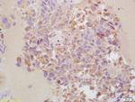 MMP-13 Antibody in Immunohistochemistry (Paraffin) (IHC (P))