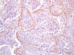 Collagen 1 Antibody in Immunohistochemistry (Paraffin) (IHC (P))