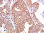 PALB2 Antibody in Immunohistochemistry (Paraffin) (IHC (P))