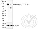 PALB2 Antibody in Western Blot (WB)