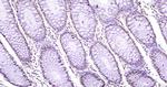 WWOX Antibody in Immunohistochemistry (Paraffin) (IHC (P))