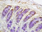 DR4 Antibody in Immunohistochemistry (Paraffin) (IHC (P))