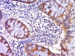 DR4 Antibody in Immunohistochemistry (Paraffin) (IHC (P))