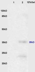 EpCAM Antibody in Western Blot (WB)