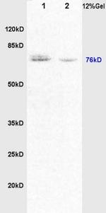 DVL1 Antibody in Western Blot (WB)