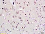 E2F1 Antibody in Immunohistochemistry (Paraffin) (IHC (P))