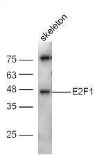 E2F1 Antibody in Western Blot (WB)