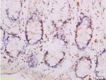 Adiponectin Receptor 1 Antibody in Immunohistochemistry (Paraffin) (IHC (P))