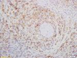 CD272 Antibody in Immunohistochemistry (Paraffin) (IHC (P))