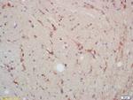 P38 MAPK Antibody in Immunohistochemistry (Paraffin) (IHC (P))