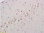 TGF beta Receptor 1 Antibody in Immunohistochemistry (Paraffin) (IHC (P))