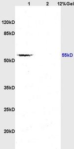 TGF beta Receptor 1 Antibody in Western Blot (WB)