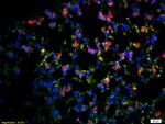 CD4 Antibody in Immunohistochemistry (Paraffin) (IHC (P))