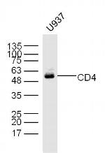 CD4 Antibody in Western Blot (WB)