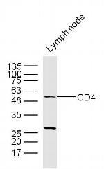 CD4 Antibody in Western Blot (WB)