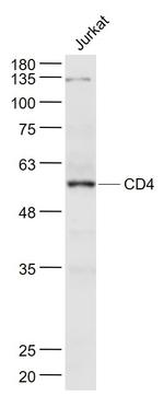 CD4 Antibody in Western Blot (WB)