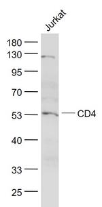 CD4 Antibody in Western Blot (WB)