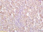 GHR Antibody in Immunohistochemistry (Paraffin) (IHC (P))