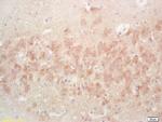 PAK5 Antibody in Immunohistochemistry (Paraffin) (IHC (P))