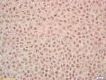 PAK5 Antibody in Immunohistochemistry (Paraffin) (IHC (P))