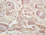 LRP Antibody in Immunohistochemistry (Paraffin) (IHC (P))