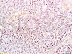 HMGB1 Antibody in Immunohistochemistry (Paraffin) (IHC (P))