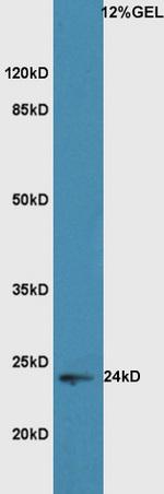 HMGB1 Antibody in Western Blot (WB)