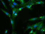 Fibronectin Antibody in Immunocytochemistry (ICC/IF)