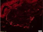 Fibronectin Antibody in Immunohistochemistry (Paraffin) (IHC (P))