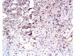 Met (c-Met) Antibody in Immunohistochemistry (Paraffin) (IHC (P))