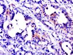 PSCA Antibody in Immunohistochemistry (Paraffin) (IHC (P))