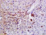 Insulin Receptor Antibody in Immunohistochemistry (Paraffin) (IHC (P))