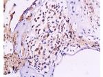 NF-M Antibody in Immunohistochemistry (Paraffin) (IHC (P))