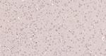 Smad2 Antibody in Immunohistochemistry (Paraffin) (IHC (P))