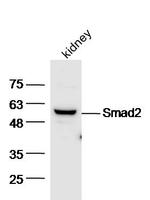 Smad2 Antibody in Western Blot (WB)