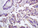 Galectin 3 Antibody in Immunohistochemistry (Paraffin) (IHC (P))