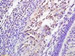 Galectin 3 Antibody in Immunohistochemistry (Paraffin) (IHC (P))