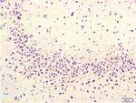 Cyclooxygenase 2 Antibody in Immunohistochemistry (Paraffin) (IHC (P))