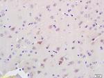 ADAMTS7 Antibody in Immunohistochemistry (Paraffin) (IHC (P))