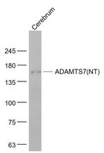 ADAMTS7 Antibody in Western Blot (WB)