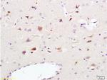 CD56 Antibody in Immunohistochemistry (Paraffin) (IHC (P))