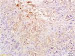 HIF-1 Alpha Antibody in Immunohistochemistry (Paraffin) (IHC (P))