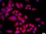 CDKN1B Antibody in Immunocytochemistry (ICC/IF)