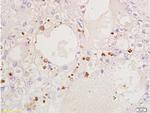 CDKN1B Antibody in Immunohistochemistry (Paraffin) (IHC (P))
